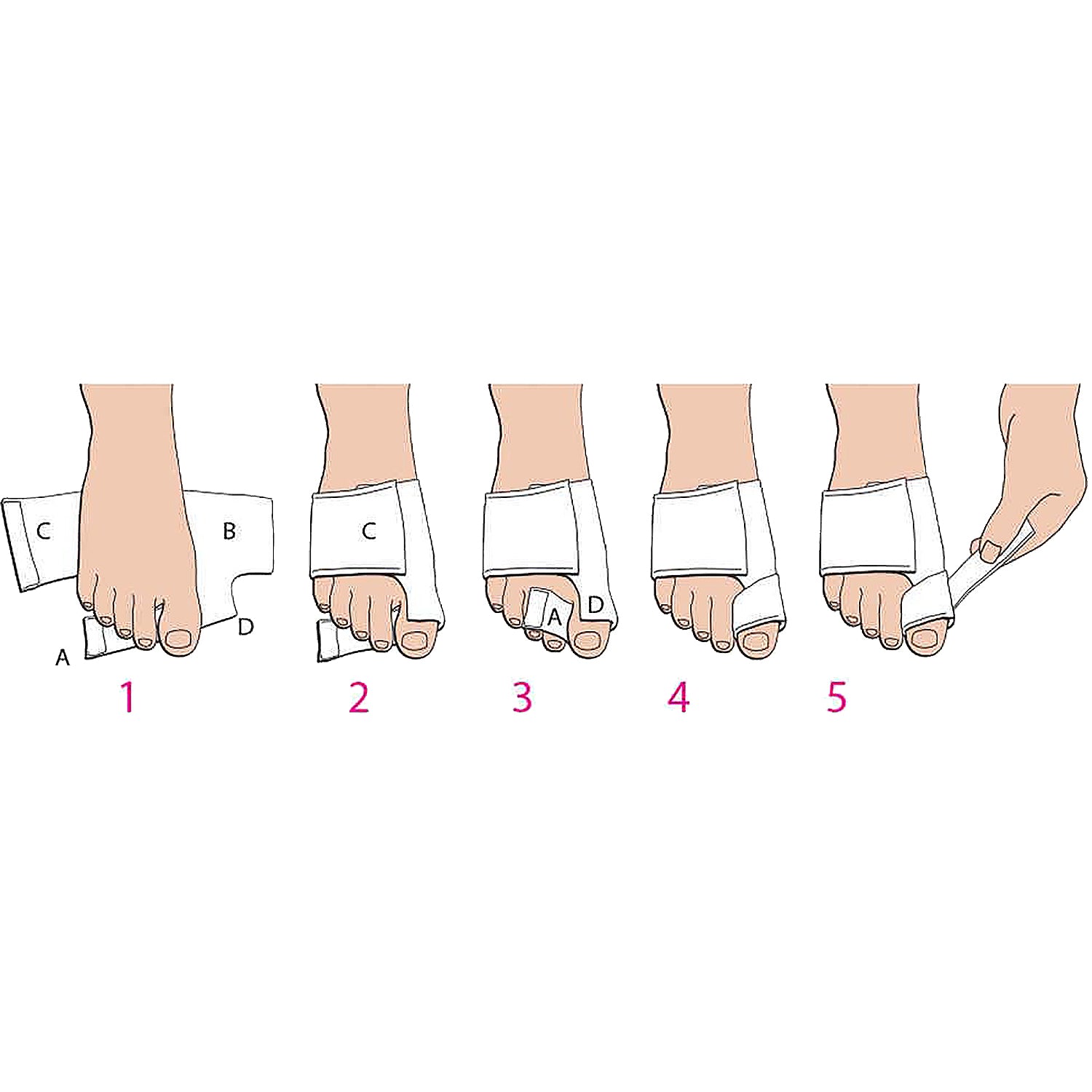 Unisex Pedifix Unisex PediFix Bunion SoftSplint